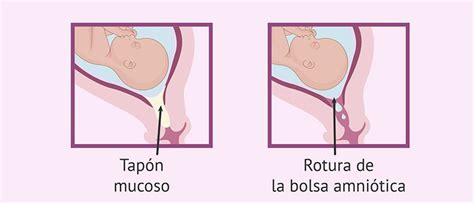 Que Es El Tapon Mucoso En El Embarazo Slidemoms