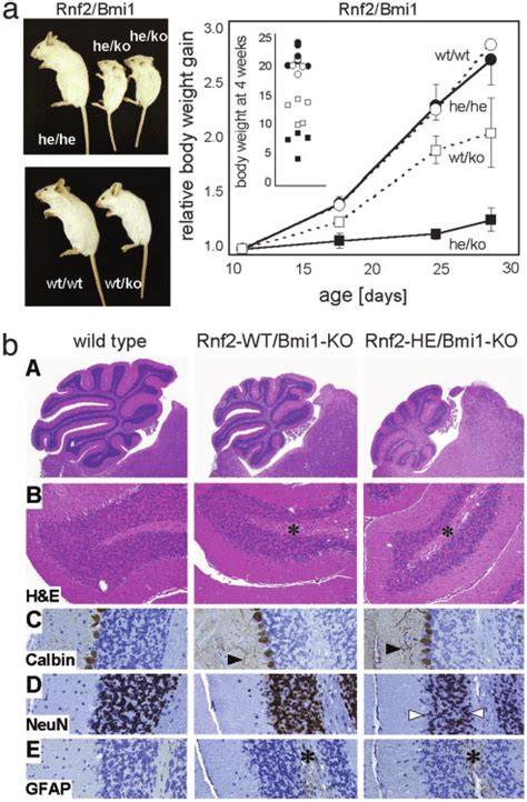 Genetic Interaction Of Rnf2 And Bmi1 Mutations A Poor Postnatal