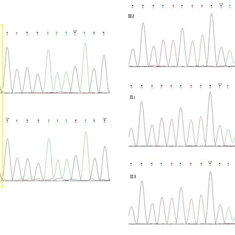 Sequence Chromatogram Showing Heterozygote State Of The Nucleotide Download Scientific Diagram