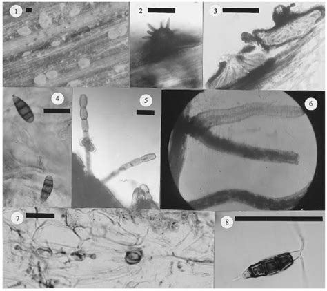 Photomicrographs Of Fungi Associated With Cannabis Scale Bars 38 µm Download Scientific