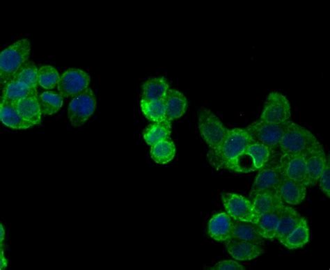 Perforin Antibody (PA5-109315)