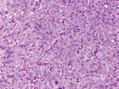 C2-FF98.gif | Abdominal Key 