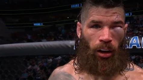 UFC 277 VIDEO BRUTAL Así le quedó la cara a Matthew Semelsberger