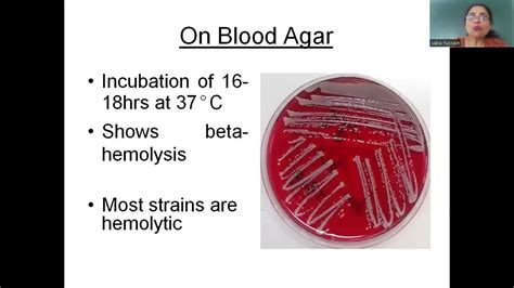 Staphylococcus Aureus Microscopic Morphology And Cultural