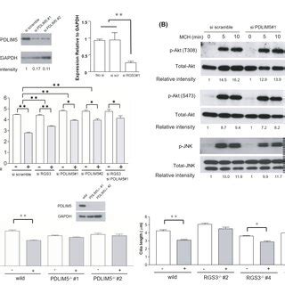 A Model Of MCHMCHR1 Signaling In Cilia Length Shortening PDLIM5 Is