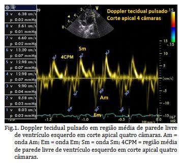 SciELO Brasil Avaliação da função diastólica por meio de Doppler