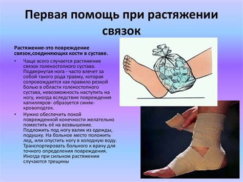 Растяжение связок: причины, симптомы, диагностика, лечение, профилактика