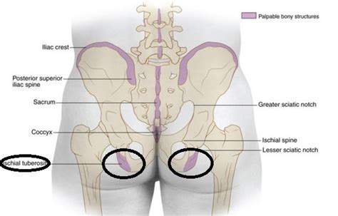 Ischial Tuberosity - Anatomy, Location, Pain, Treatment, Pictures