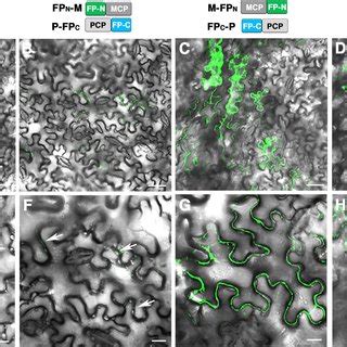 GFP background fluorescence was not detected in cells with... | Download Scientific Diagram