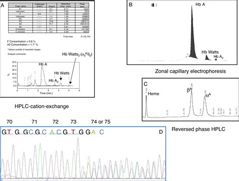 Delta 0 Thalassemia By Insertion Of 27 Base Pairs In δ Globin Gene With Decreased Hemoglobin A