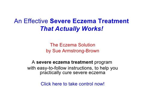 Severe Eczema Treatment