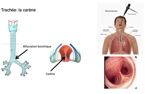 Appareil Respiratoire Sémiologie Pathologie Cartes Quizlet