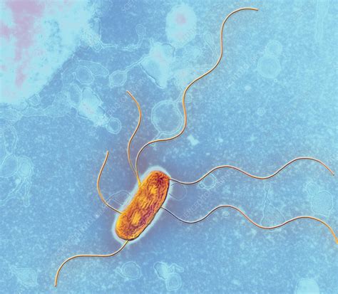 Escherichia Coli Strain Stock Image B Science Photo Library