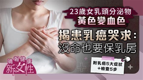 健康新女性23歲女乳頭分泌物黃色變血色 揭患乳癌哭求醫生就算沒命也要保住乳房 晴報 健康 女性疾病 D220906