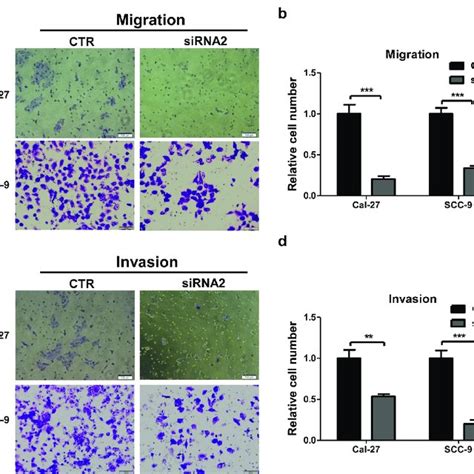 Linc01296 Knockdown Inhibits Hnscc Cell Migration And Invasion In