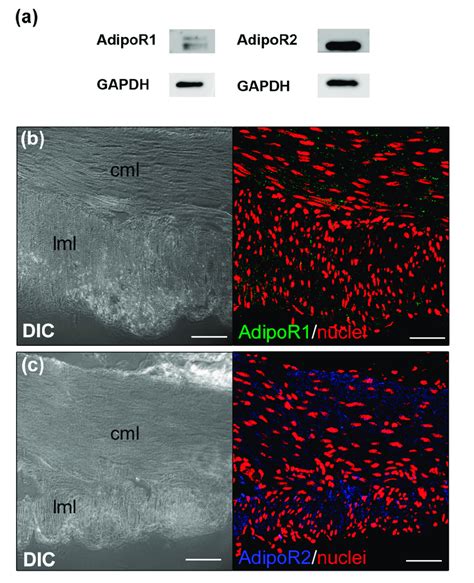 Adiponectin receptor 1 (AdipoR1) and 2 (AdipoR2) expression and ...