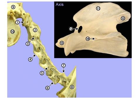 P1 Vertebras Cervicales Equino Vista Lateral Diagram Quizlet