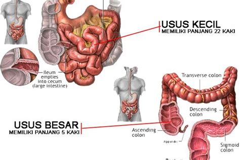 Mahasiswa Ugm Kembangkan Skrining Kanker Usus Besar Republika Online