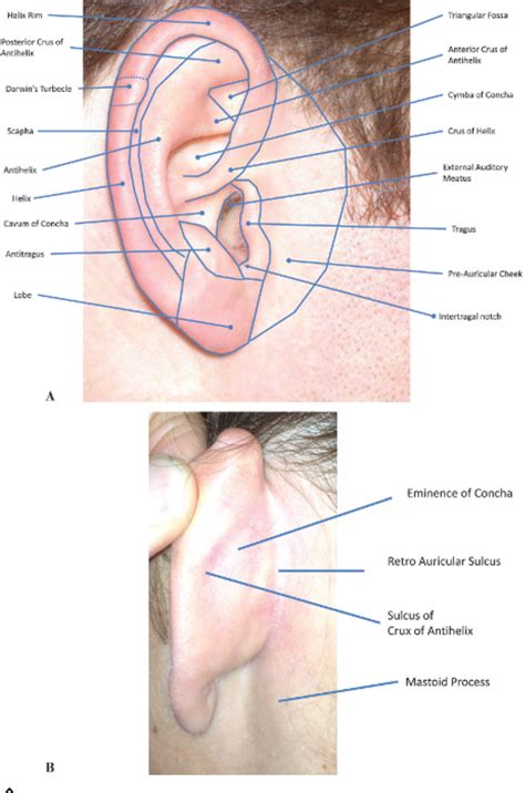 Posterior Ear Anatomy Diagram