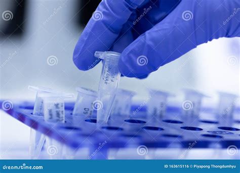 Reacción De La Cadena De La Polimerasa Pcr Y Electroforesis Del Gel De