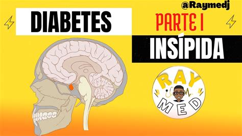 DIABETES INSÍPIDA Definición fisiopatología y tipos YouTube