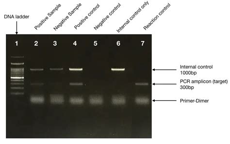 Type Of Pcr Controls Negative Positive And Internal Controls