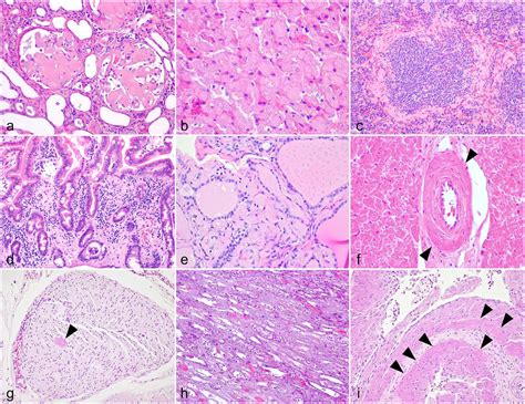 Light Chain Al Amyloidosis Symptoms In Cats And Dogs - Infoupdate.org