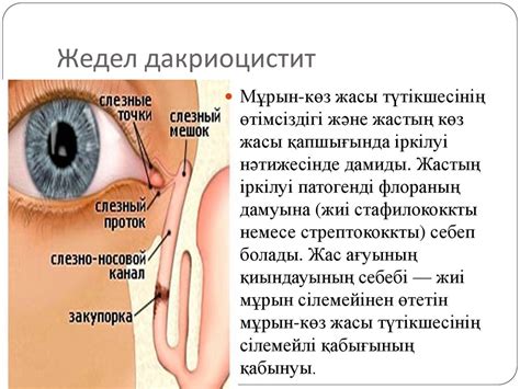 Көз жасы мүшесінің патологиясы. Дакриоцистит, жас нүктесінің тарылуы ...
