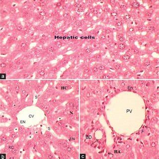 A C Photomicrograph Of Transverse Section Of Liver H And E Of