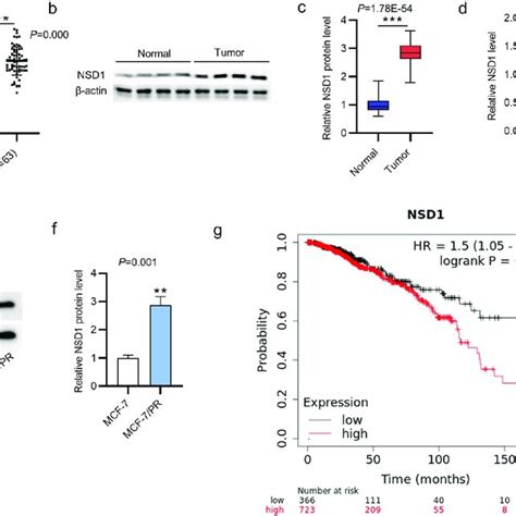 NSD1 Promotes The Proliferation And Inhibits The Apoptosis Of BC Cells