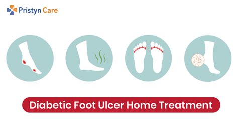 Diabetic Foot Ulcer Home Treatment