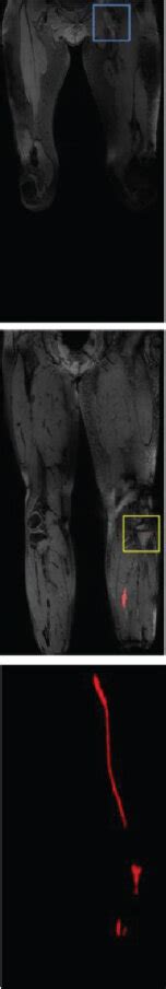 Representative Segmentation Results Of A Patient Obtained From An Download Scientific Diagram