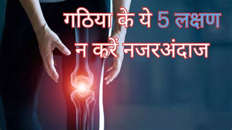 Arthritis Symptoms In Hindi गठिया के लक्षण क्या होते हैं गठिया के