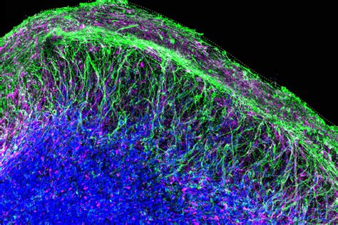 Brain Organoids Provide a Window Into Autism - Neuroscience News