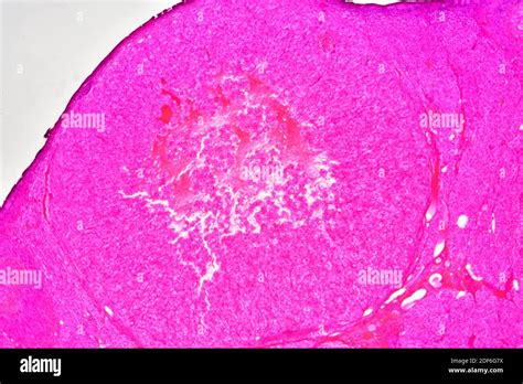 Human Corpus Luteum Slide