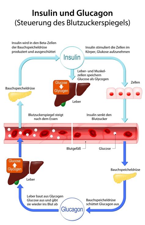 Wie Entsteht Ein Diabetes