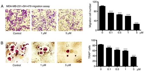 SH 479 Inhibits Osteoclast Differentiation And Breast Cancer Cell