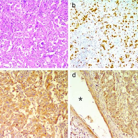 Representative Examples Of Hematoxylin And Eosin He And Download