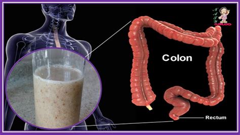 INCREÍBLE MIRA COMO Limpia tu colon y pierde 10 kilos en 3 semanas