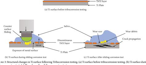 PDF Bio Tribocorrosion Of Titanium Dental Implants And Its