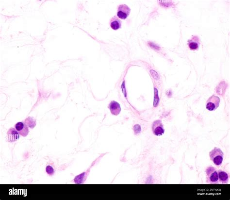 Plasma Cells Are B Lymphocytes Activated By The Presence Of Antigens