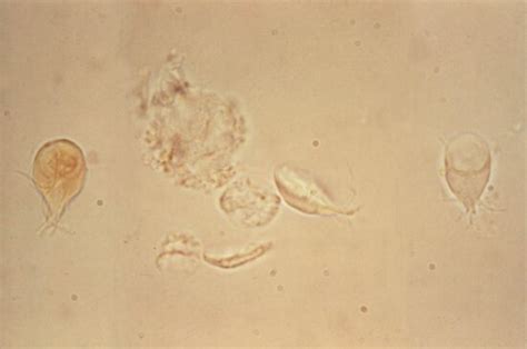 Free Picture Giardia Lamblia Trophozoites Small Intestine Appear Pear Shaped Organisms