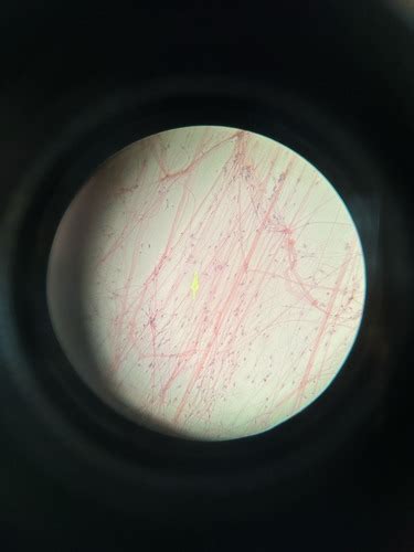 Lab 4 Connective Nervous And Muscle Tissue Flashcards Quizlet