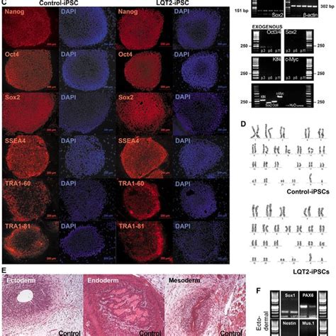 Mutation And Ecg Analysis A Mutation Analysis Confirmed The Herg