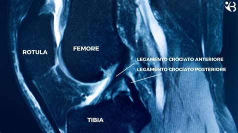 Legamento Crociato Anteriore Chirurgia E Riabilitazione Atlas