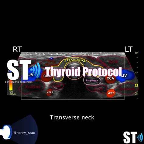 Thyroid Ultrasound Protocol – Sonographic Tendencies