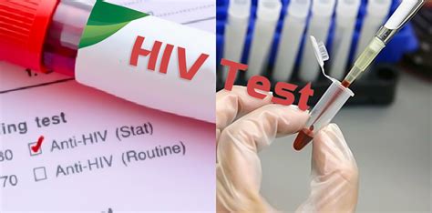 Dấu hiệu triệu chứng hiv aids phổ biến và cách phòng ngừa hiệu quả