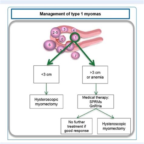 Figo Classification Of Uterine Fibroids According To Download