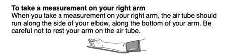 Blood Pressure Cuff Arrow Placement – Which Way Does It Go?