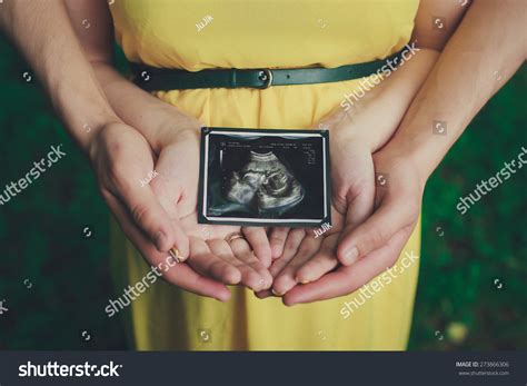 Hands Holding Ultrasound Baby Photo Stock Photo 273866306 | Shutterstock